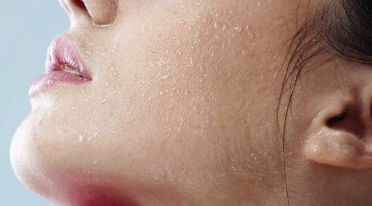 Giải quyết hiệu quả vấn đề da mặt bị dị ứng nổi sần ngứa