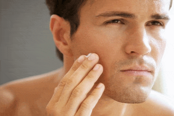 Nám da nam giới: Nguyên nhân, triệu chứng và cách điều trị hiệu quả