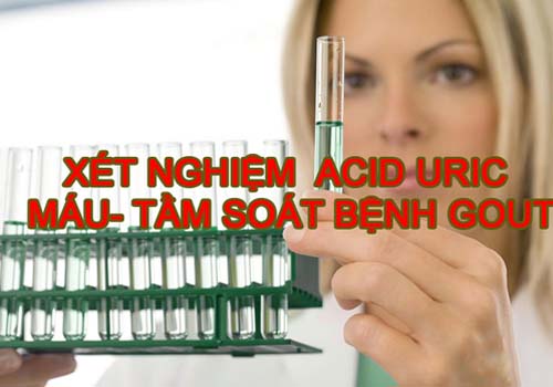 Chỉ số axit uric – Tìm hiểu về nguyên nhân, triệu chứng và cách điều trị