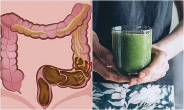 Cách thải độc ruột hiệu quả và an toàn: Hướng dẫn đầy đủ và chi tiết