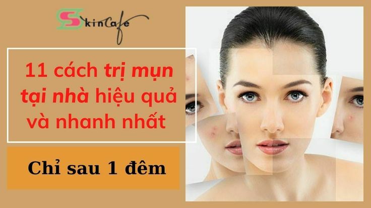 Cách trị mụn tại nhà hiệu quả sau 1 đêm đơn giản và hiệu quả