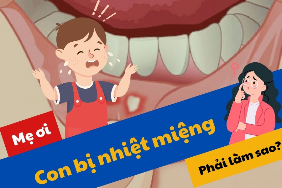 Những phương pháp hiệu quả giúp tạm biệt nhanh chóng với nhiệt miệng