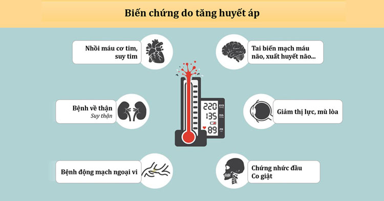 Giải quyết hiệu quả biến chứng tăng huyết áp với các phương pháp chăm sóc sức khỏe