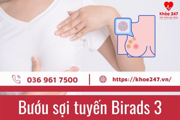 Bướu sợi tuyến Birads 3: Tìm hiểu đầy đủ và chính xác về căn bệnh này