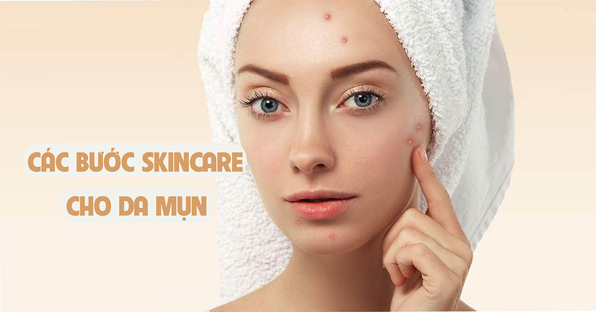 Cẩm nang chăm sóc da mụn: Hướng dẫn chi tiết các bước đơn giản và hiệu quả