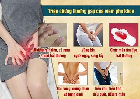 Dấu hiệu viêm phụ khoa nặng - Dấu hiệu, nguyên nhân và cách điều trị hiệu quả