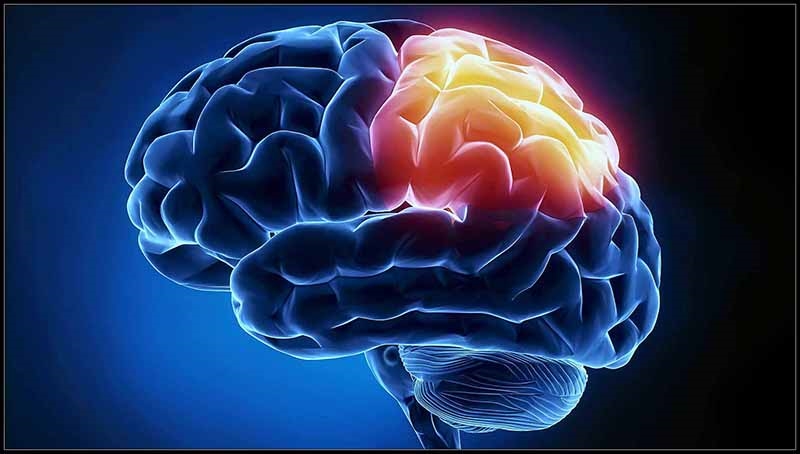 Giải mã nguyên nhân và cách chữa đau nửa đầu bên phải hiệu quả