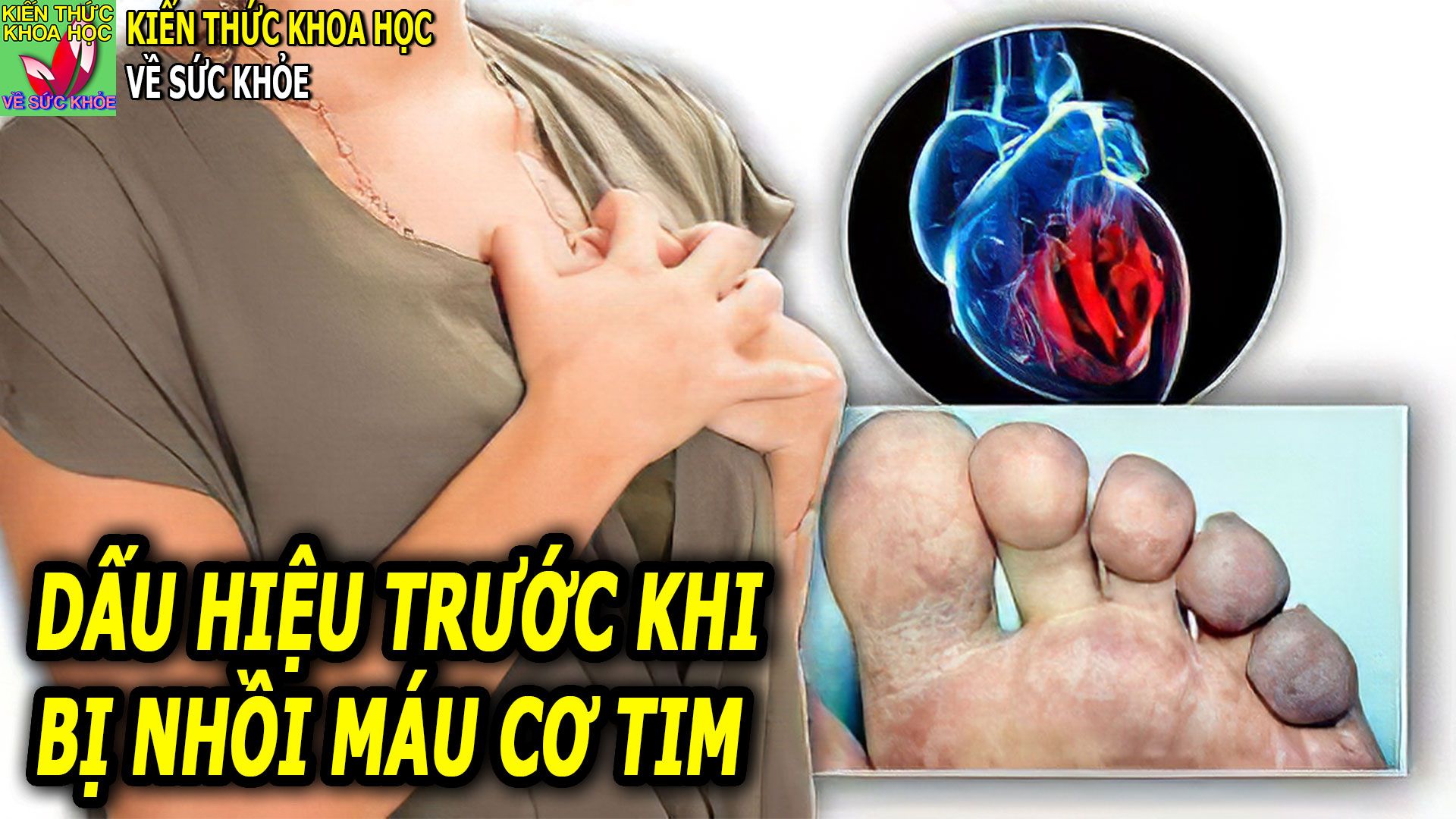 Dấu hiệu nhồi máu cơ tim ở phụ nữ: Tìm hiểu và phòng ngừa