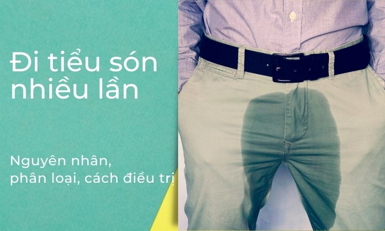 Giải pháp hiệu quả cho triệu chứng tiểu nhiều - Tìm hiểu ngay!