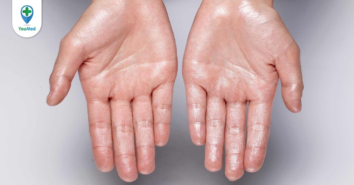 Cách chữa bệnh đổ mồ hôi tay chân tại nhà hiệu quả và an toàn