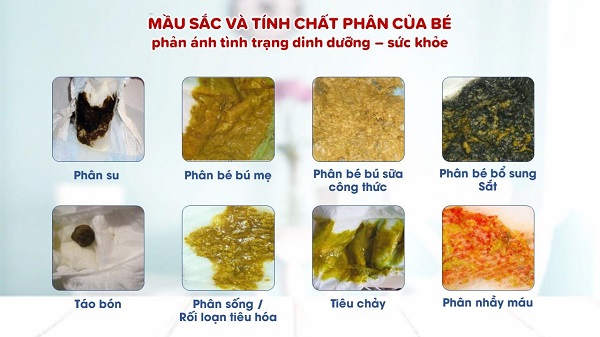 Chăm sóc phân sống ở trẻ sơ sinh: Những kiến thức thiết yếu và phương pháp thực hiện