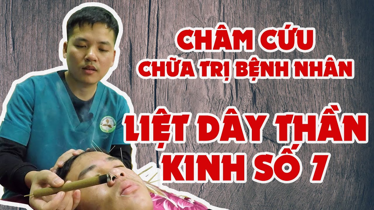 Châm cứu liệt dây thần kinh số 7 - Phương pháp chữa trị hiệu quả từ y học cổ truyền