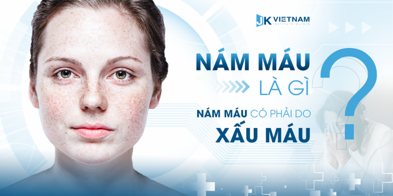 Nám da do máu xấu: nguyên nhân, cách phòng ngừa và điều trị hiệu quả