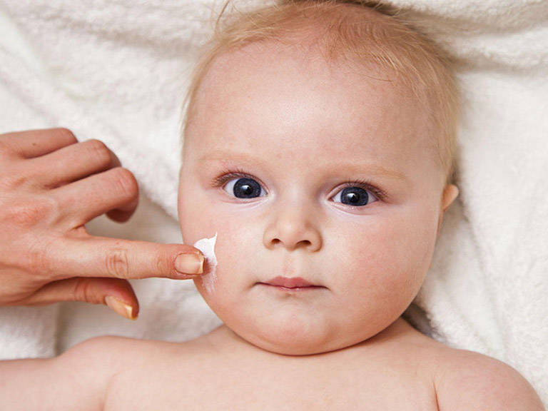 Giải quyết triệt để vấn đề nổi mề đay ở trẻ với các phương pháp chăm sóc da hiệu quả
