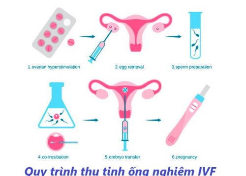 Làm IVF chuyên nghiệp tại địa chỉ uy tín – Trung tâm điều trị hiện đại