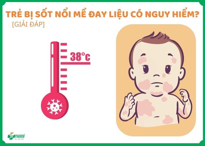 Giải quyết triệt để vấn đề nổi mề đay ở trẻ với các phương pháp chăm sóc da hiệu quả