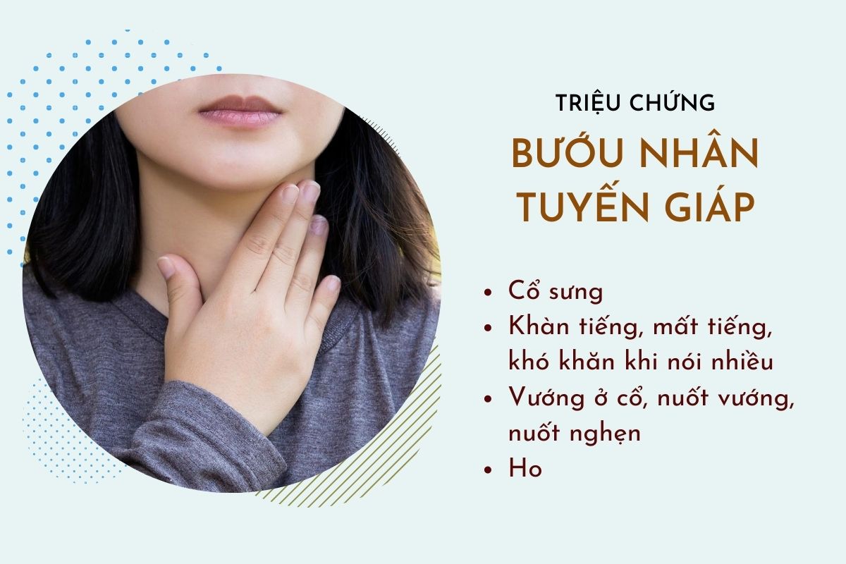 Chẩn đoán và điều trị bướu giáp đa nhân không độc – Kiến thức bổ ích về sức khỏe