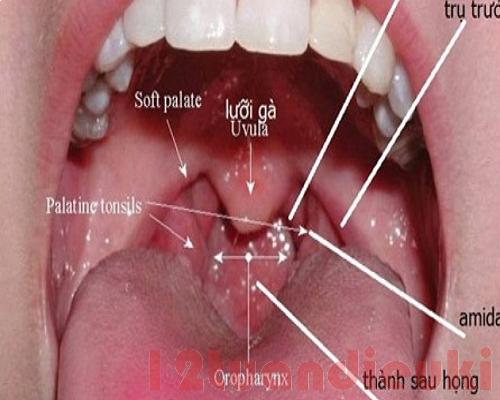 Dấu hiệu của ung thư vòm họng – Tầm quan trọng trong việc phát hiện và điều trị
