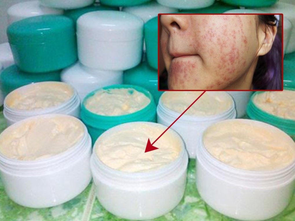 Tránh xa các loại mỹ phẩm không nguồn gốc, xuất xứ với quảng cáo “trên trời”