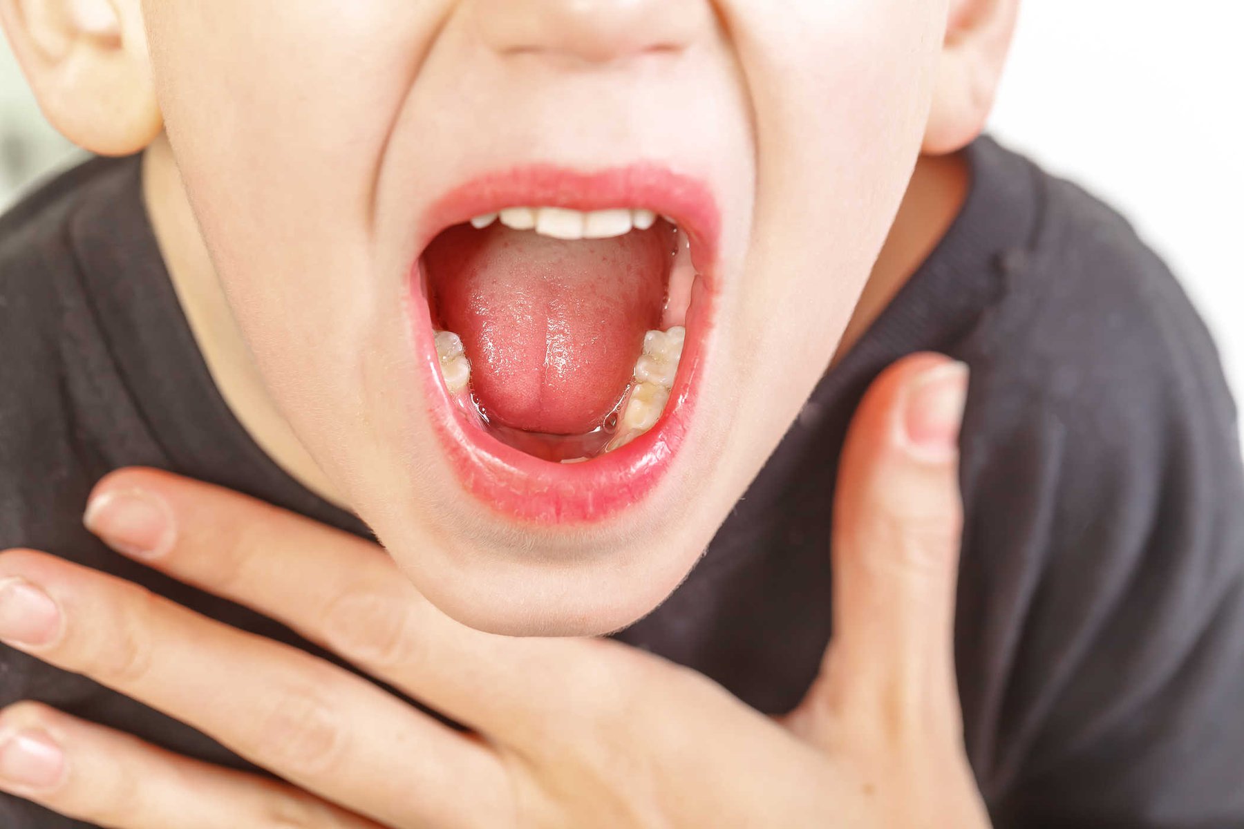 Cách làm tan đờm trong cổ họng cho trẻ hiệu quả và an toàn