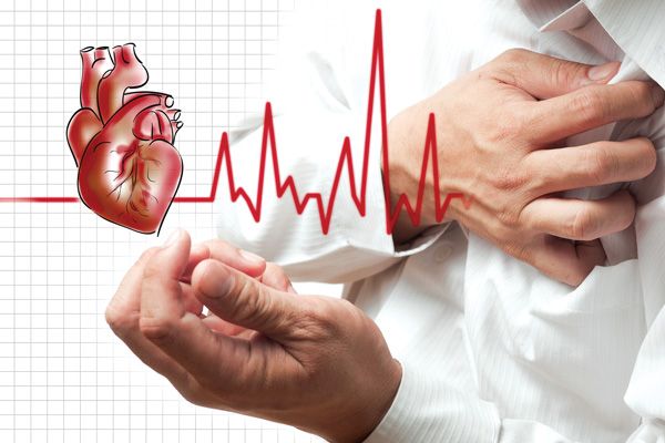 Triệu chứng nhồi máu cơ tim nhẹ: Nguyên nhân, triệu chứng và cách điều trị
