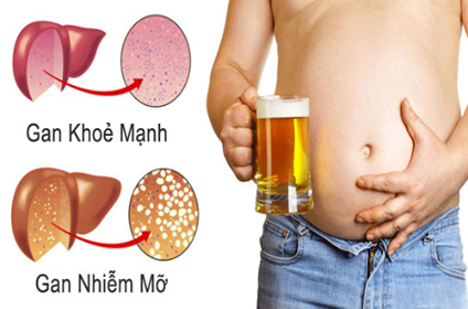 Tác hại của rượu bia và cách giảm thiểu nguy cơ sức khỏe