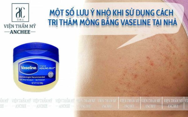 Trị thâm mông hiệu quả với phương pháp sử dụng Vaseline