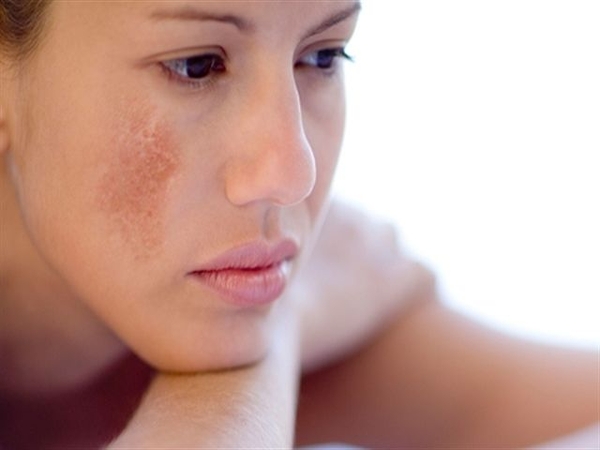 Chăm sóc da sau sinh chuyên nghiệp và hiệu quả – Tips và sản phẩm được chia sẻ