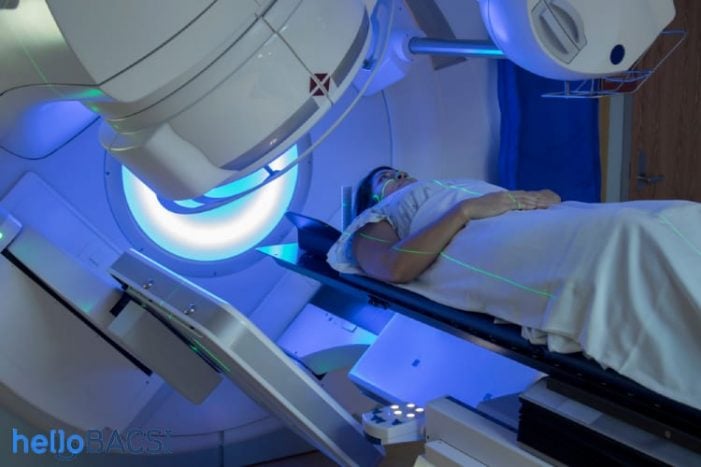 Ung thư giai đoạn 1: Cần xạ trị hay không? Tìm hiểu và giải đáp từ chuyên gia