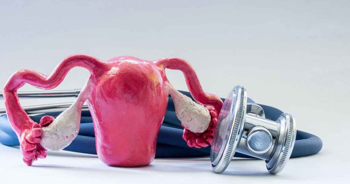 Giải pháp hiệu quả để khắc phục tình trạng tắc vòi trứng hiệu quả. 2